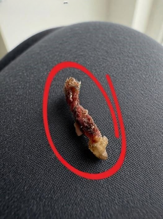I Woke Up Feeling Like Something Was Biting My Upper Back: What Could It Be?