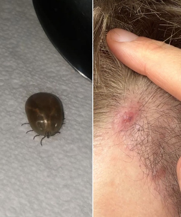 How to Stay Calm When You Find Unwanted “Guests” in Your Child’s Hair