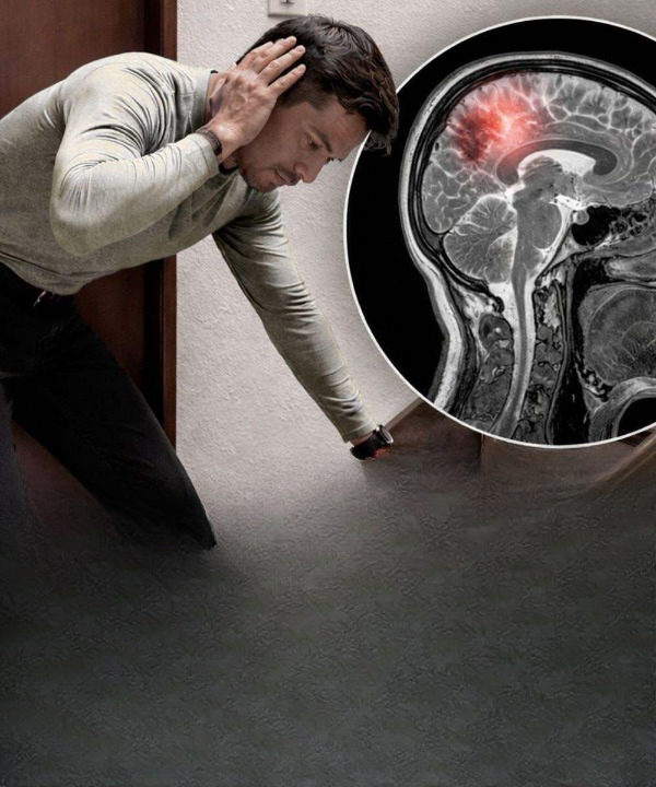 Silent but Deadly: The Warning Signs of Aneurysm Every Man Should Know Before It’s Too Late