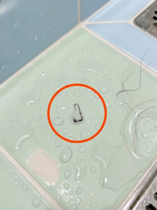I Was Taking a Shower When I Suddenly Noticed Something on My Shoulder—What I Thought Was a Terrifying Parasite Turned Out to Be Something Completely Different