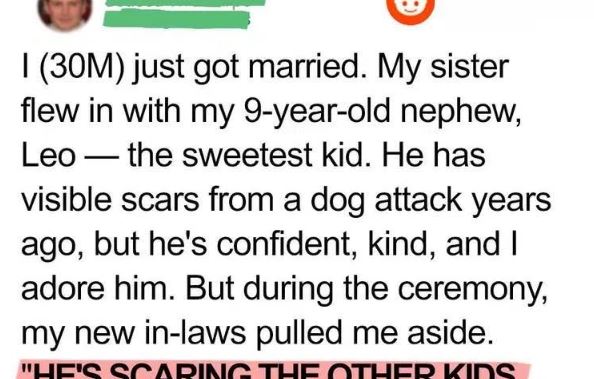 My In-Laws Tried to Ban My Scarred Nephew From Our Wedding — My Wife’s Response Left Them Speechless